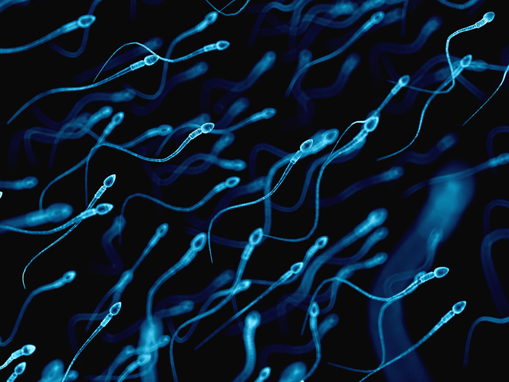 iStock-490478936_1024x768px Spermien